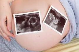 Twin Pregnancy Announcement